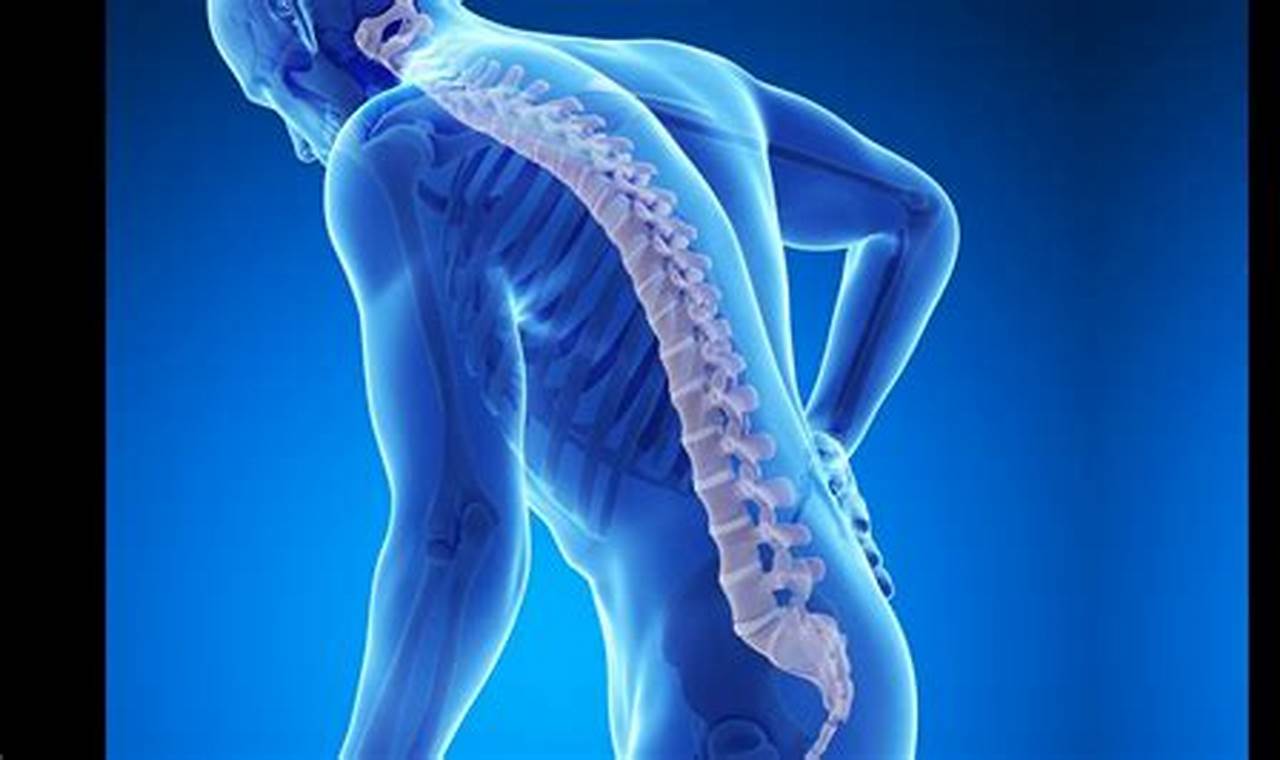 Cara Mengatasi Osteoporosis